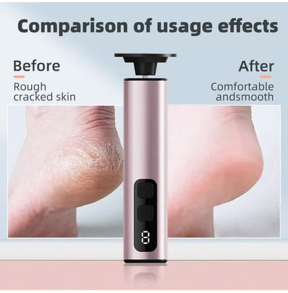 Purple Rechargeable Electric Foot File with 9 Speed Settings - Callus Remover for Smooth Feet