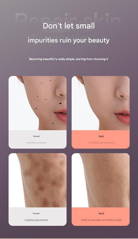 Professional 9-Level Skin Tag & Spot Remover Pen - USB Rechargeable Beauty Device(Blue)