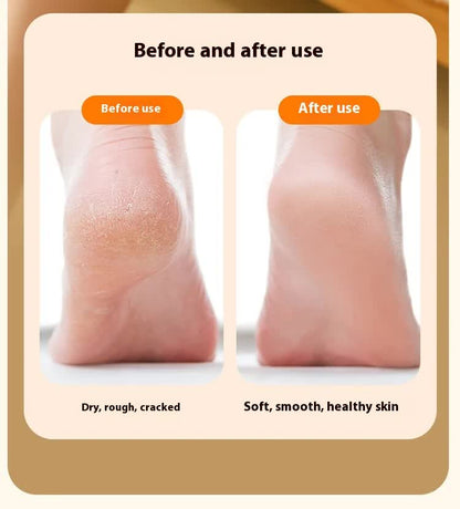 Electric Foot Callus Remover Rechargeable Pedicure Tool with 3 Grinding Heads Portable Dead Skin Exfoliator Peach Pink