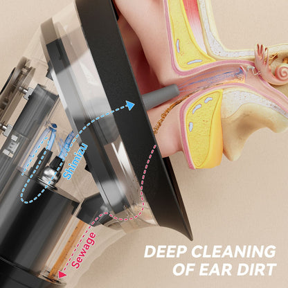 E80 Professional Electric Ear Irrigation and Ear Wax Removal Kit - Type-C Charging, 3 Pressure Levels, 2-in-1 230ML Sewage & Shimizu Tank & 12 Specialized Nozzles(4pcs 1-hole Nozzles +4pcs 3-hole Nozzles + 4pcs 5-hole Nozzles)