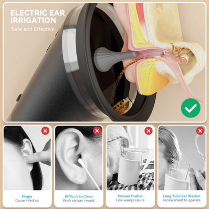 E80 Professional Electric Ear Irrigation and Ear Wax Removal Kit - Type-C Charging, 3 Pressure Levels, 2-in-1 230ML Sewage & Shimizu Tank & 12 Specialized Nozzles(4pcs 1-hole Nozzles +4pcs 3-hole Nozzles + 4pcs 5-hole Nozzles)