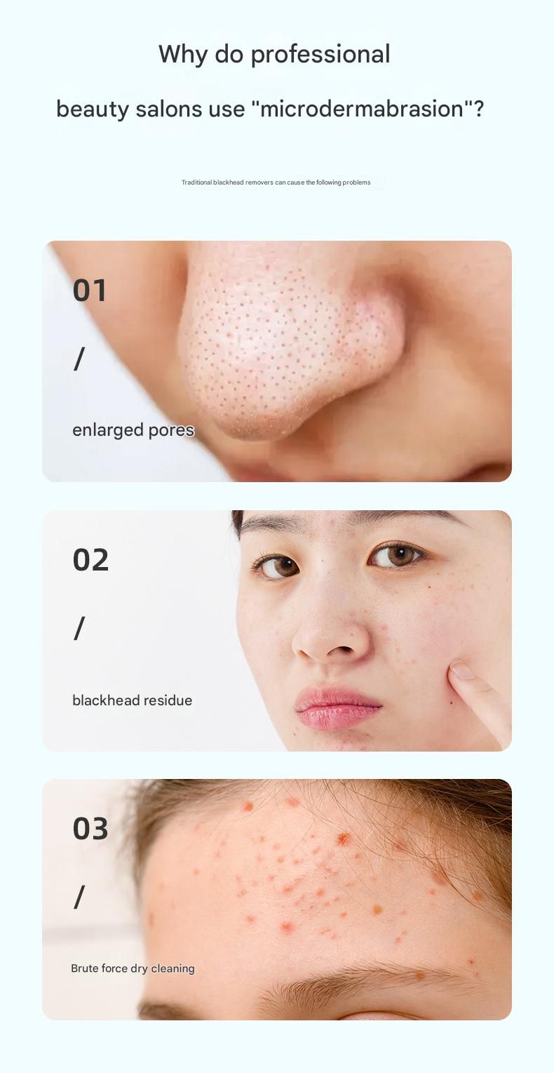 White Heated Micro-Bubble Blackhead Remover Vacuum Pore Cleaner - 46C Hot Compress Electric Water Cycle Facial Cleansing Device with 6 Suction Heads 3 Modes