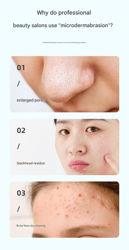 White Heated Micro-Bubble Blackhead Remover Vacuum Pore Cleaner - 46C Hot Compress Electric Water Cycle Facial Cleansing Device with 6 Suction Heads 3 Modes
